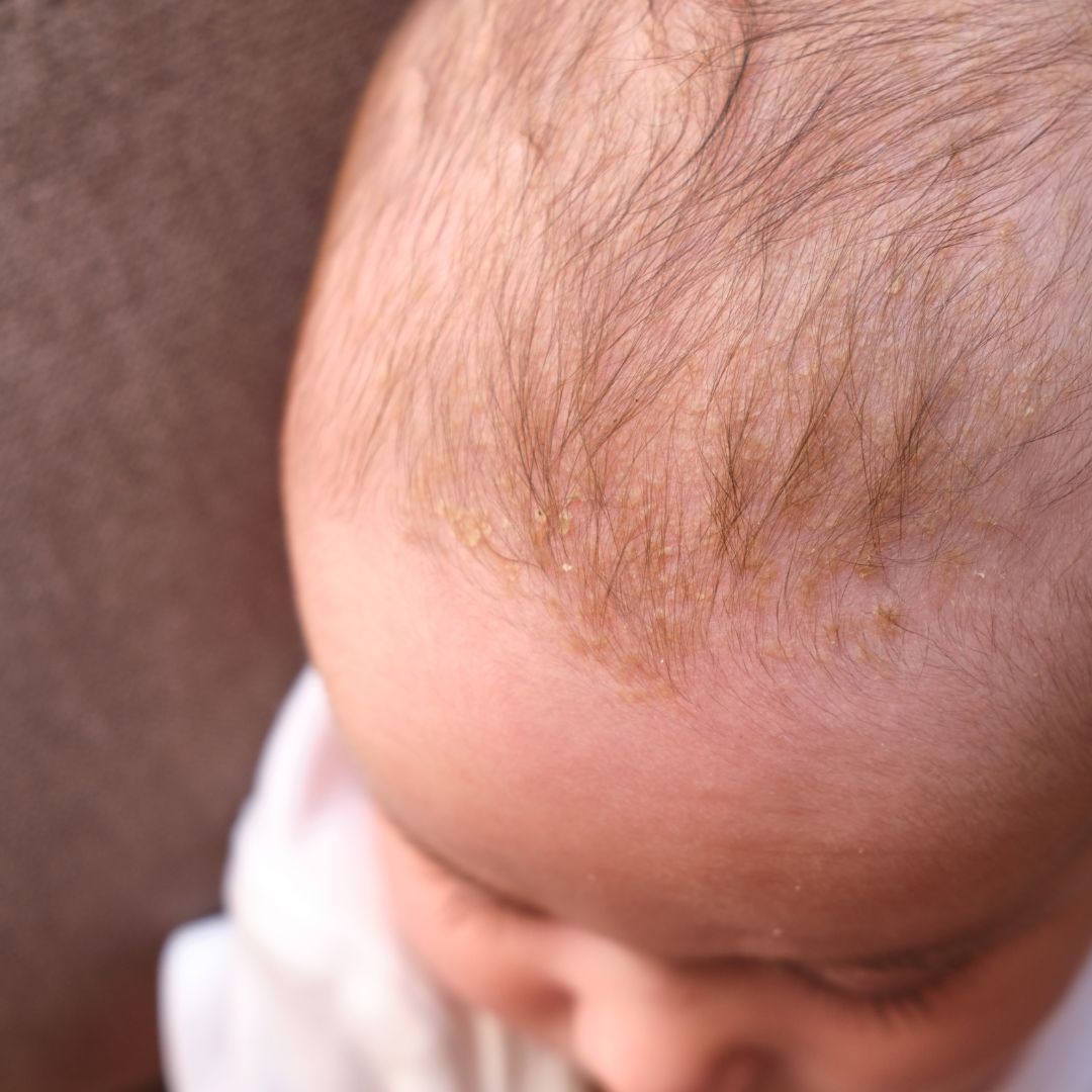 A close view of the soft skin and hair on a newborn's head